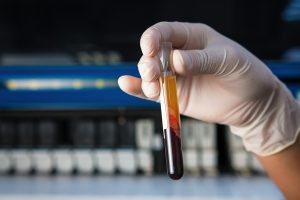 Blood tube at the microbiology laboratory
